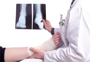 doctor checking broken bones after an accident