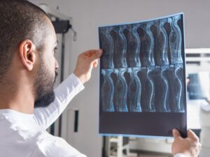 doctor looking at a spinal cord MRI