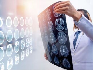 TBI lawyers in Lexington