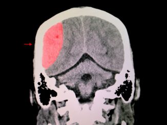 brain injury xray