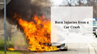 Burn Injuries from a Car Crash
